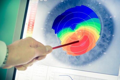 What Is Corneal Mapping & How Does it Work?